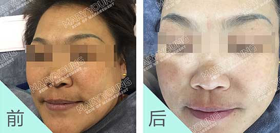 项目对比
