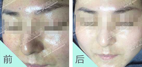 项目对比