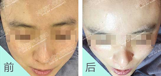 项目对比