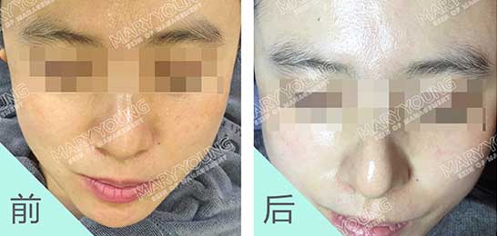 项目对比