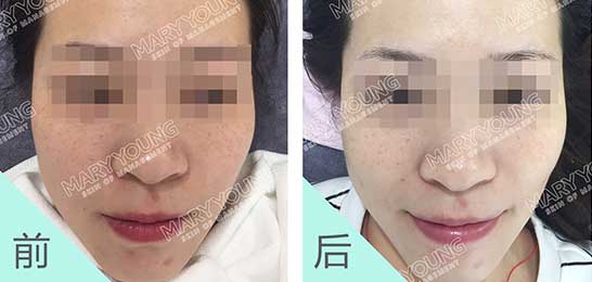 项目对比