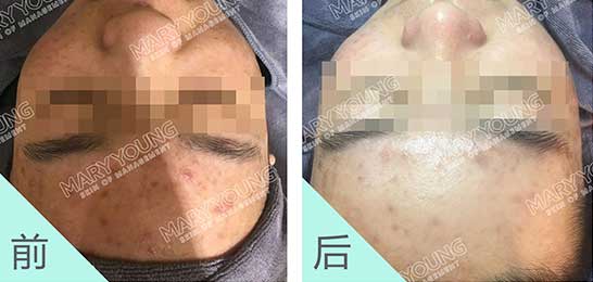 项目对比