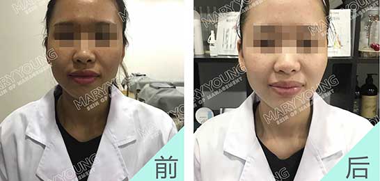 项目对比