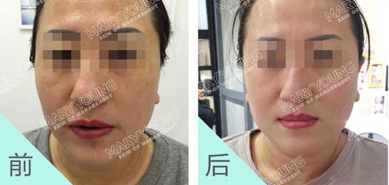 项目对比