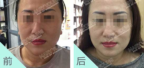 项目对比