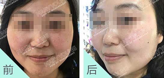项目对比