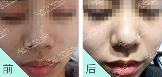 项目对比