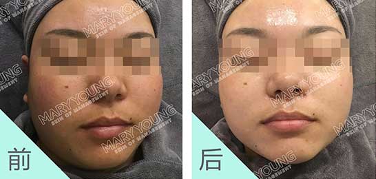 项目对比