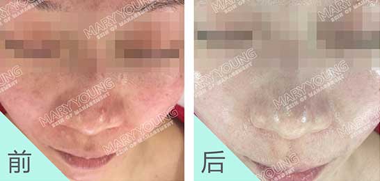 项目对比